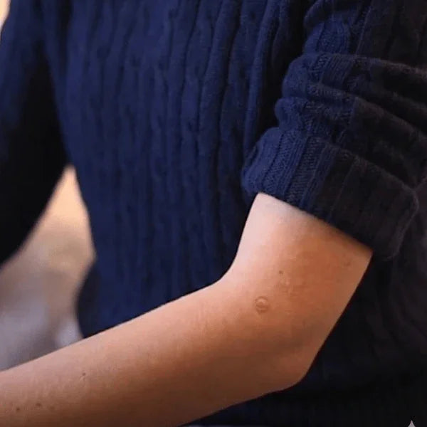 Acu Pyramid Standard - 200 units/Box