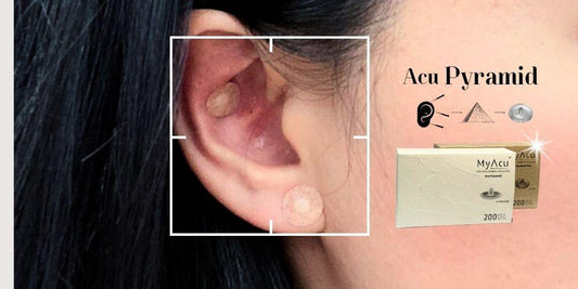 A Needle-Free Solution for Sensitive Patients: How the MyAcu Acu Pyramid Supports and Extends Acupuncture Treatments - Herbprime